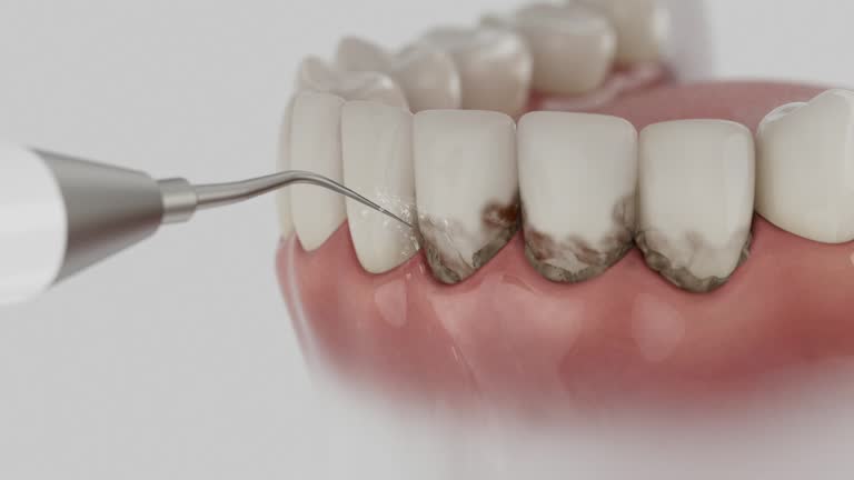 Reliable Dental Implants contractor in L'Anse, MI by Smile Center Dentistry